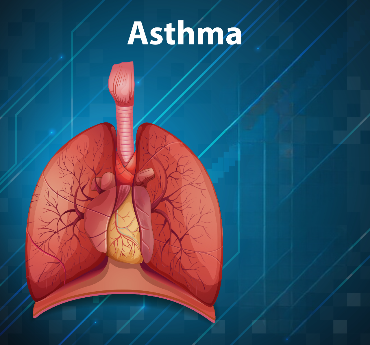 Managing Asthma in Kerala’s Humid Climate: Tips and Tricks