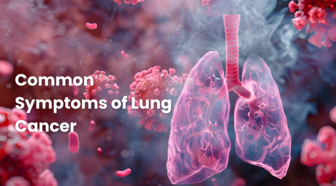 Common Symptoms of Lung Cancer: What You Need to Know